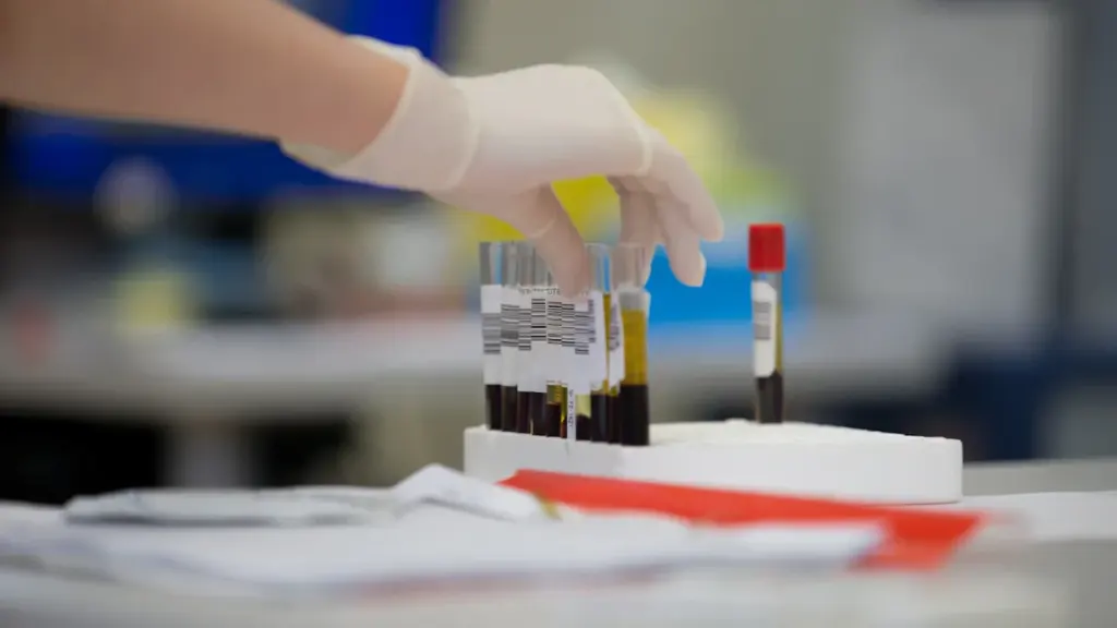 Gros plan sur une main gantée manipulant des tubes de prélèvement sanguin médical