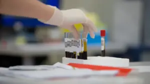 Gros plan sur une main gantée manipulant des tubes de prélèvement sanguin médical